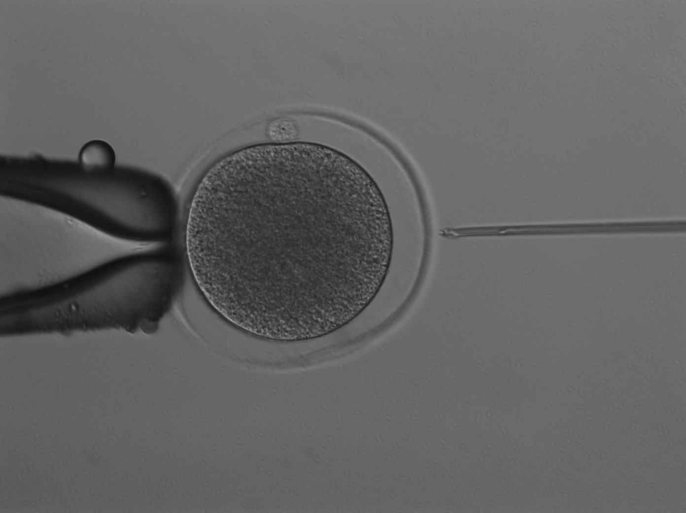 IVF