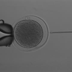 IVF