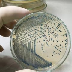 Bacteria in petri dish