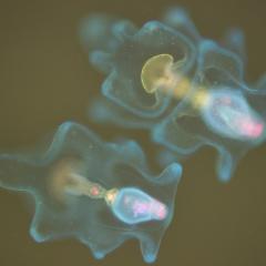 Two-week old crown-of-thorns starfish larvae under a florescence microscope. The tiny red/pink dots are microalgae food in their stomach.